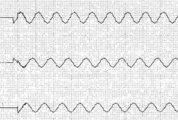電容補償柜用晶閘管開關(guān)投切時波形圖
